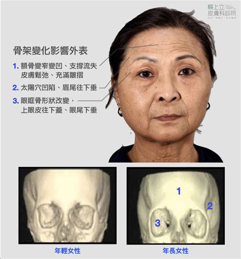 夫妻宮凹陷化解 怎麼知道有沒有被下符